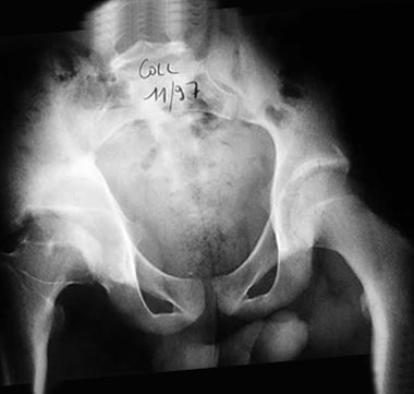 Xray image